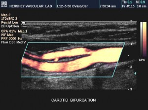 Carotid